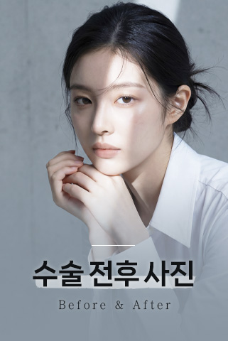 수술 전후 사진