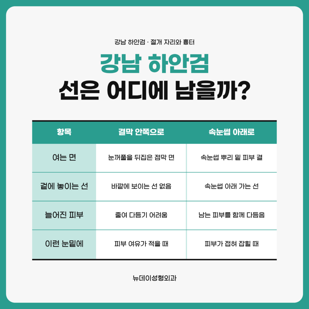 강남 하안검에서 아래 눈꺼풀 안쪽 점막으로 여는 길과 속눈썹 아래 피부로 여는 길을 항목별로 견주어 정리한 뉴데이성형외과 자료 이미지